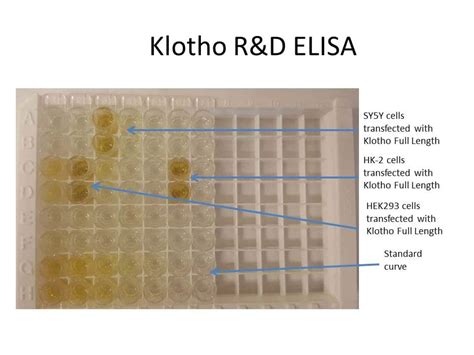 Human Klotho DuoSet ELISA 